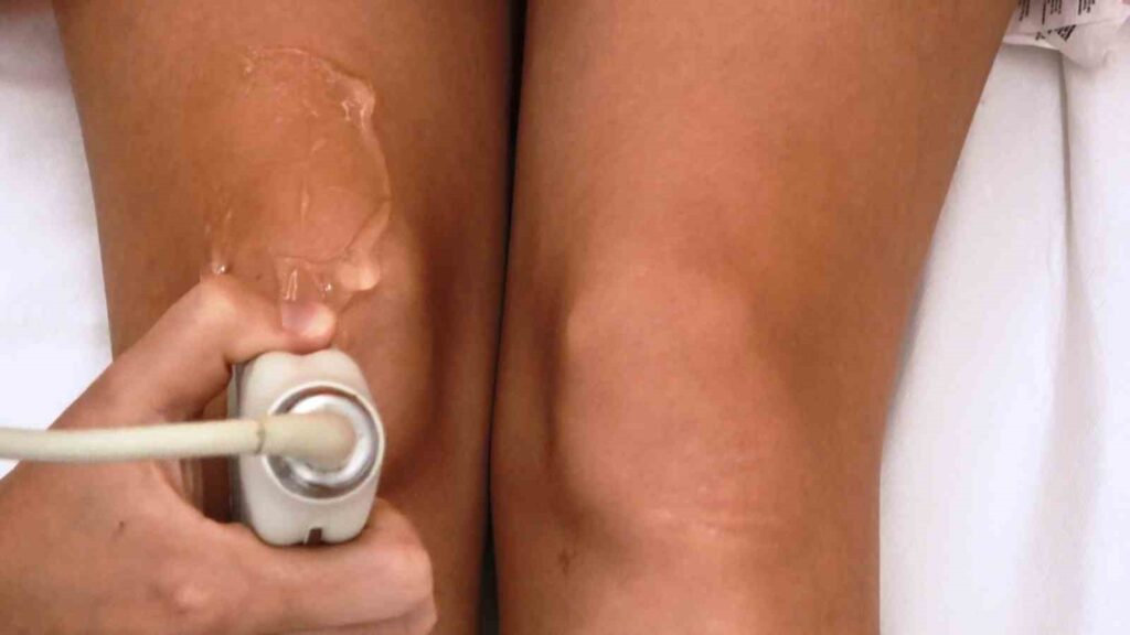 Nuove Sviluppi e Metodi di Trattamento nell’Osteoartrite del Ginocchio
